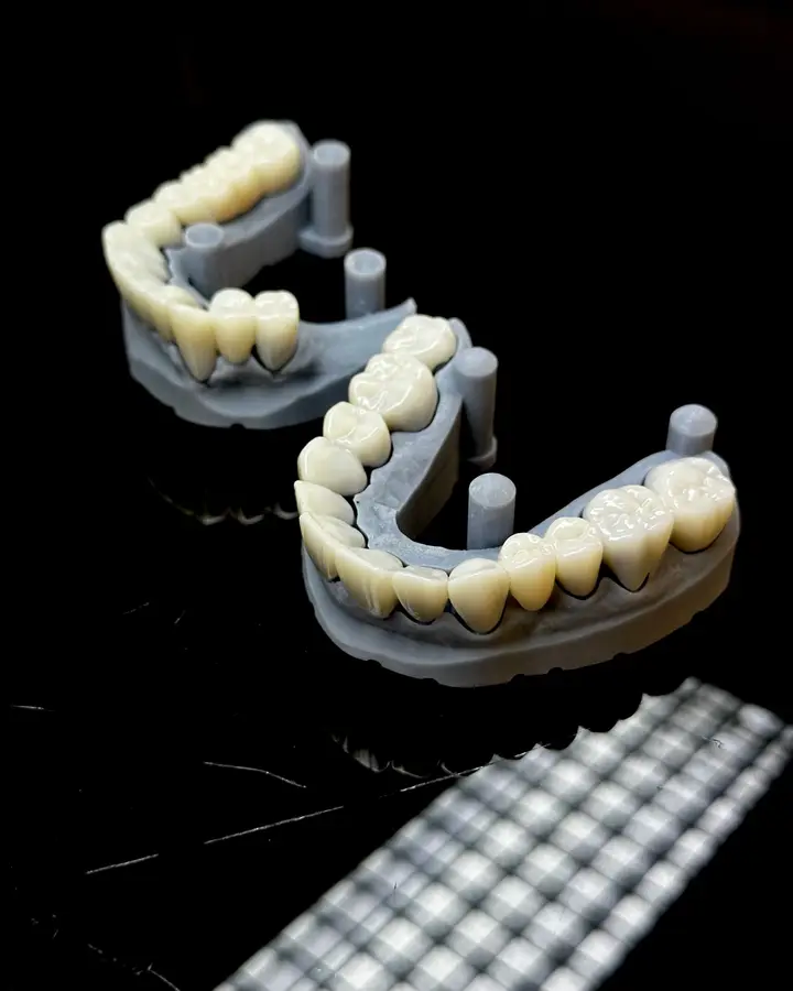 Zirconia crown